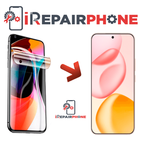 Protector de Pantalla Hidrogel HONOR 400