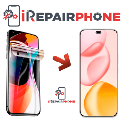 Protector de Pantalla Hidrogel HONOR 400 Pro